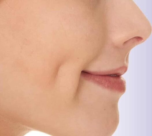 Dimple Creation in Indore