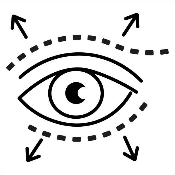 Blepharoplasty in Indore illustrating upper and lower eyelid correction procedure