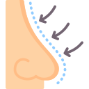 Rhinoplasty in Indore illustrating nasal structure and nose reshaping concept