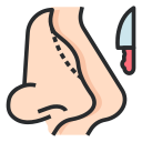 Rhinoplasty in Indore illustrating nasal structure and nose reshaping concept