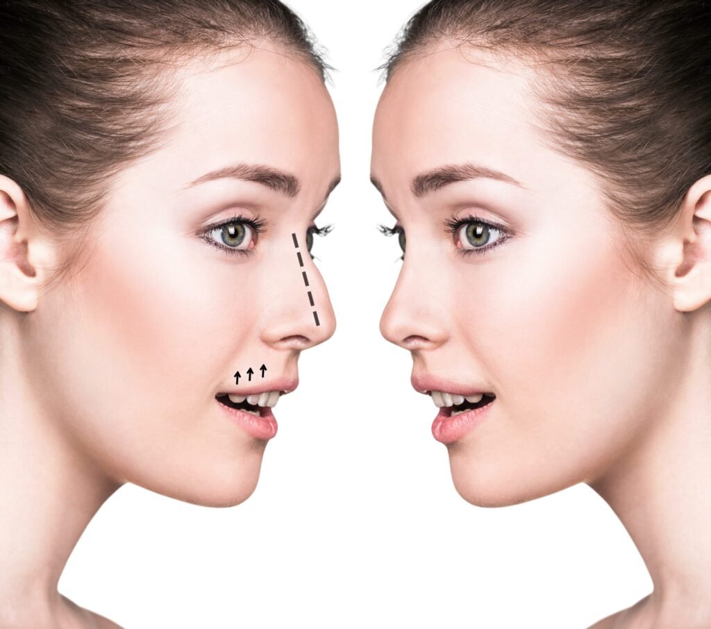 Rhinoplasty in Indore illustrating nasal structure and nose reshaping concept