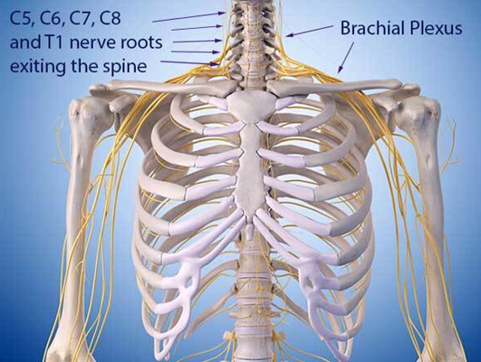 Brachial plexus surgery in Indore showing nerve injury types and reconstruction anatomy